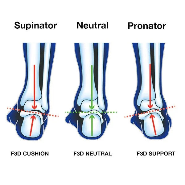 Diagram to show how the 1000 mile UP advanced sports insoles work with feet types